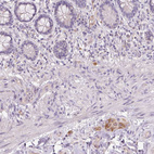 Immunohistochemical staining of human small intestine shows moderate cytoplasmic positivity in peripheral ganglion.