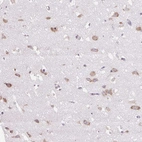 Anti-GPR45 Antibody