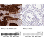 Anti-TNNI2 Antibody