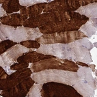 Immunohistochemical staining of human skeletal muscle shows strong cytoplasmic positivity in myocytes.