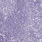 Immunohistochemical staining of human lymph node shows no positivity in non-germinal center cells as expected.