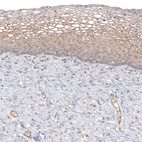 Immunohistochemical staining of human cervix shows moderate cytoplasmic positivity in squamous epithelial cells.