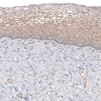Immunohistochemical staining of human cervix shows moderate cytoplasmic positivity in squamous epithelial cells.