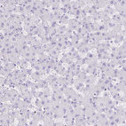 Anti-TNNI2 Antibody