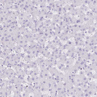 Immunohistochemical staining of human liver shows no positivity in hepatocytes as expected.
