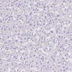 Immunohistochemical staining of human liver shows no positivity in hepatocytes as expected.