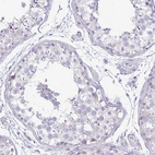 Immunohistochemical staining of human testis shows no positivity in cells in seminiferous ducts as expected.