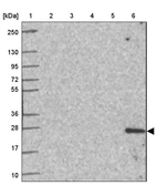 Lane 1: Marker [kDa] 250, 130, 95, 72, 55, 36, 28, 17, 10_br/_Lane 2: Human cell line RT-4_br/_Lane 3: Human cell line U-251 MG_br/_Lane 4: Human plasma_br/_Lane 5: Human Liver tissue_br/_Lane 6: Human Tonsil tissue