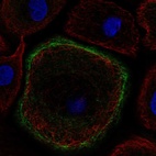 Anti-TNNI2 Antibody