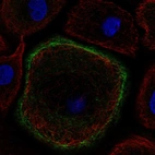 Immunofluorescent staining of human cell line hTCEpi shows localization to plasma membrane.