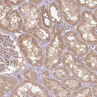 Immunohistochemical staining of human kidney shows moderate cytoplasmic positivity in cells in tubules.