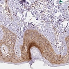 Immunohistochemical staining of human skin shows strong cytoplasmic positivity in keratinocytes.