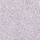 Immunohistochemical staining of human liver shows no cytoplasmic positivity in hepatocytes as expected.