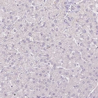 Immunohistochemical staining of human liver shows no cytoplasmic positivity in hepatocytes as expected.