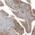 Immunohistochemical staining of human fallopian tube shows moderate membranous positivity in glandular cells.