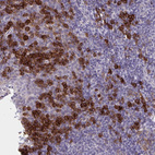 Immunohistochemical staining of human tonsil shows moderate membranous positivity in non-germinal center cells.
