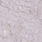 Immunohistochemical staining of human skeletal muscle shows no positivity in myocytes as expected.