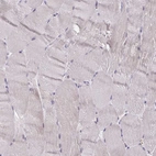 Immunohistochemical staining of human skeletal muscle shows no positivity in myocytes as expected.