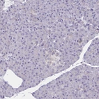 Immunohistochemical staining of human pancreas shows no positivity in exocrine glandular cells as expected.