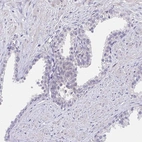 Immunohistochemical staining of human prostate shows no positivity in glandular cells as expected.