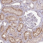 Anti-OR6K3 Antibody