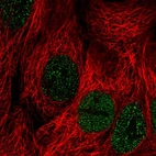 Immunofluorescent staining of human cell line CACO-2 shows localization to nucleoplasm.