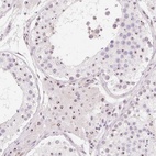 Anti-OBP2A Antibody