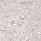 Immunohistochemical staining of human skeletal muscle shows very weak cytoplasmic positivity in myocytes.
