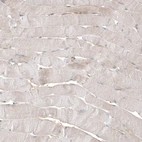 Immunohistochemical staining of human skeletal muscle shows very weak cytoplasmic positivity in myocytes.