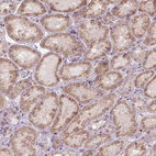 Anti-NUDT3 Antibody