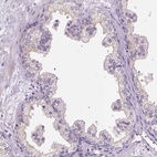 Immunohistochemical staining of human prostate shows no positivity in glandular cells as expected.