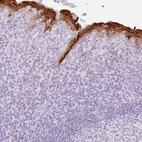 Immunohistochemical staining of human tonsil shows strong cytoplasmic-nucleus positivity in squamous epithelial cells.