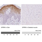 Immunohistochemistry analysis in human skin and skeletal muscle tissues using HPA055963 antibody. Corresponding SPRR4 RNA-seq data are presented for the same tissues.