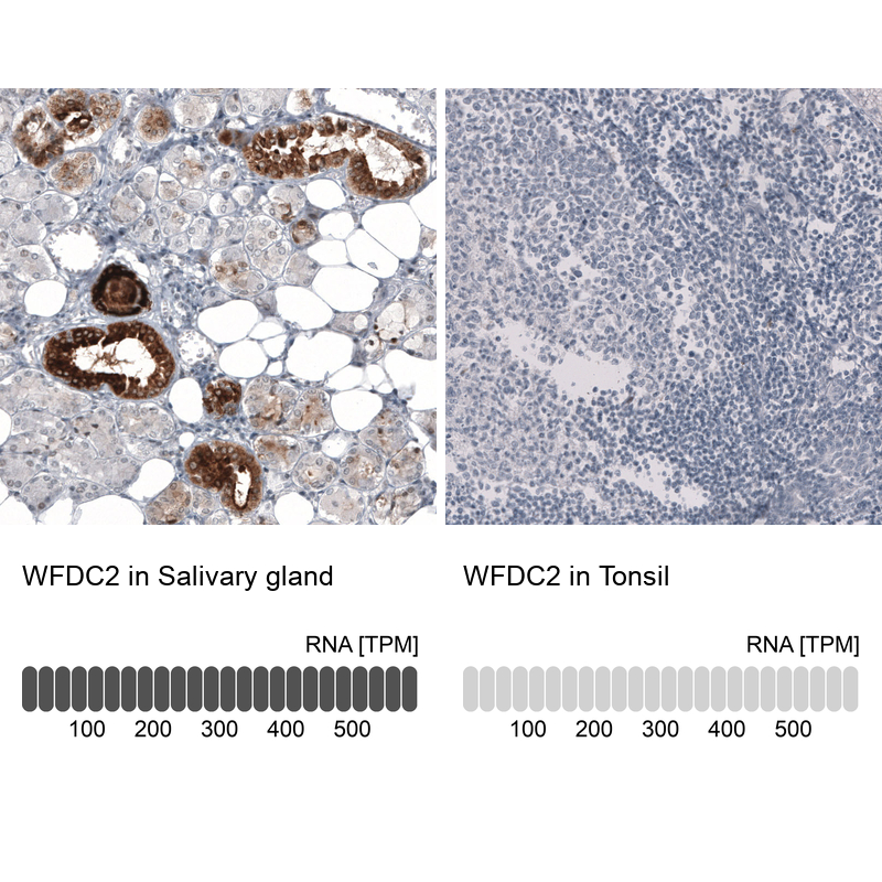 Anti-WFDC2 Antibody