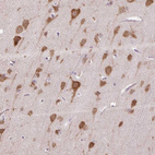 Anti-HABP4 Antibody