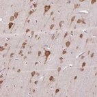Immunohistochemical staining of human cerebral cortex shows strong cytoplasmic positivity in neuronal cells.