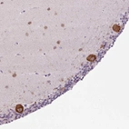 Immunohistochemical staining of human cerebellum shows strong cytoplasmic positivity in Purkinje cells.