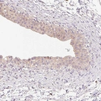 Immunohistochemical staining of human urinary bladder shows weak to moderate cytoplasmic positivity in urothelial cells.