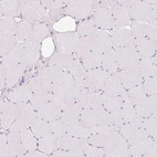 Immunohistochemical staining of human skeletal muscle shows no positivity in myocytes as expected.