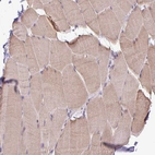 Immunohistochemical staining of human skeletal muscle shows weak cytoplasmic positivity in myocytes.