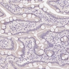 Immunohistochemical staining of human duodenum shows no cytoplasmic positivity in glandular cells as expected.