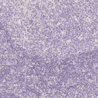 Anti-MBOAT7 Antibody