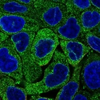 Immunofluorescent staining of human cell line RT4 shows localization to cytosol.