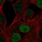 Anti-POU3F1 Antibody