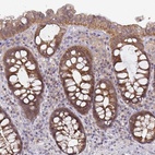 Anti-GSTM1 Antibody