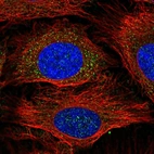 Immunofluorescent staining of human cell line HeLa shows localization to cytosol.
