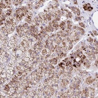 Anti-ANKRD9 Antibody