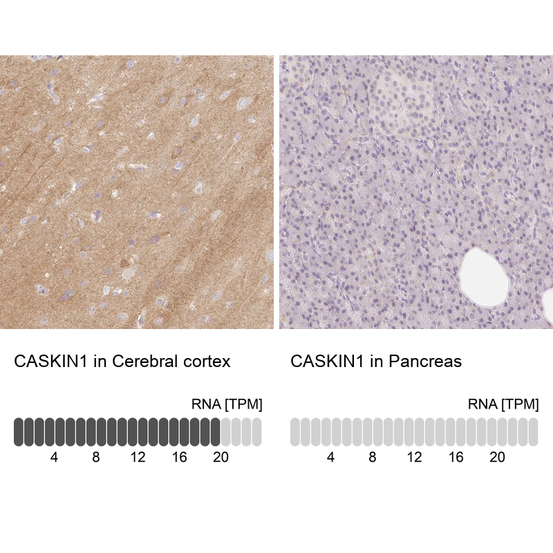 Anti-CASKIN1 Antibody
