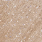 Immunohistochemical staining of human cerebral cortex shows high expression.