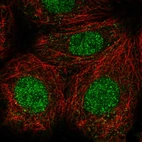 Immunofluorescent staining of human cell line MCF7 shows localization to nucleus.